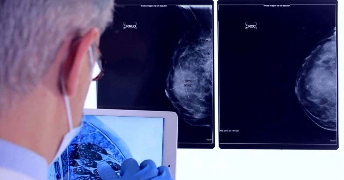 Cincy-based company using AI to diagnose heart disease risk during a mammogram [Video]