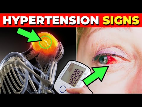 6 Warning Signs of High Blood Pressure (Hypertension) [Video]