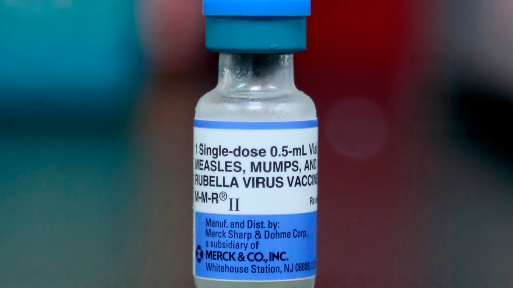 Ontario measles case count nears 10-year high [Video]