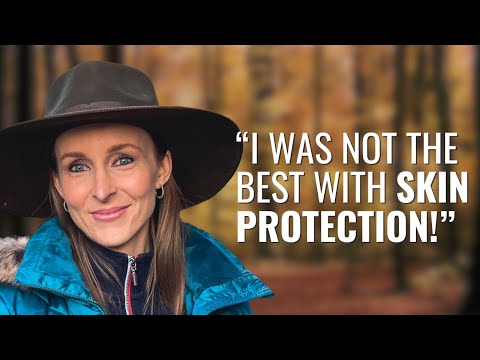 How I Found Out I Had SKIN CANCER! – Amy | Melanoma | The Patient Story [Video]