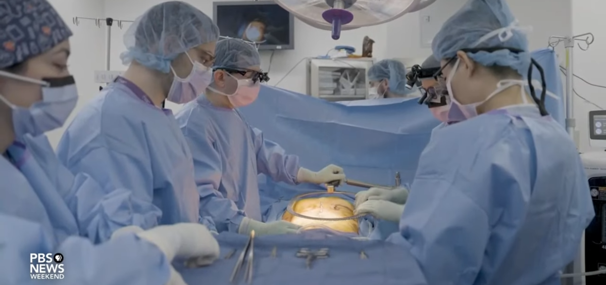 How Americas organ transplant system can be improved [Video]