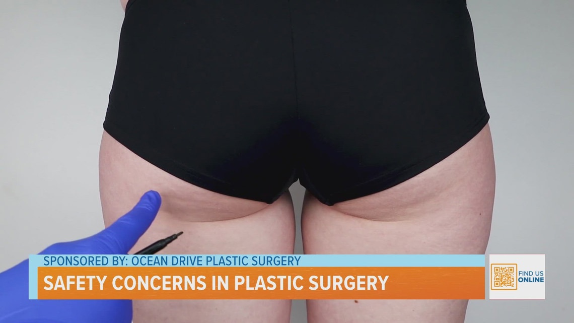Safety Concerns In Plastic Surgery [Video]