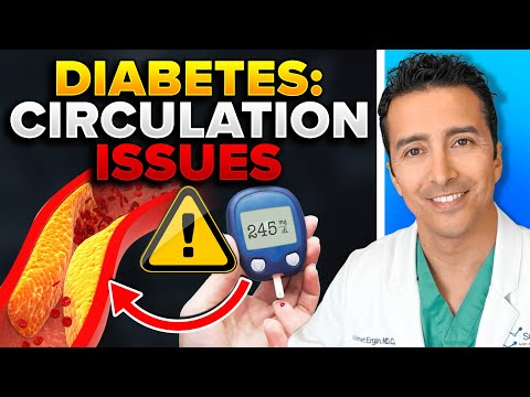 Almost Every Diabetic Would Have A Circulation Issue Unless.. [Video]