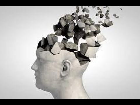 Alzheimers Disease | Understanding Coping and Supporting | Mysteries of Memory Loss [Video]