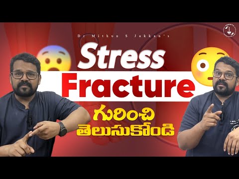 STRESS FRACTURES – CAUSES, SYMPTOMS AND TREATMENT by Dr Mithun S Jakkan [Video]