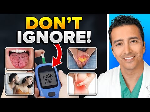 10 URGENT Signs Your Blood Sugar Is CRITICALY High! [Video]