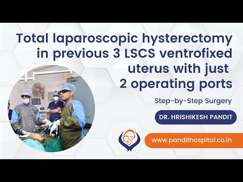 Total laparoscopic hysterectomy in previous 3 LSCS ventrofixed uterus with just 2 operating ports [Video]