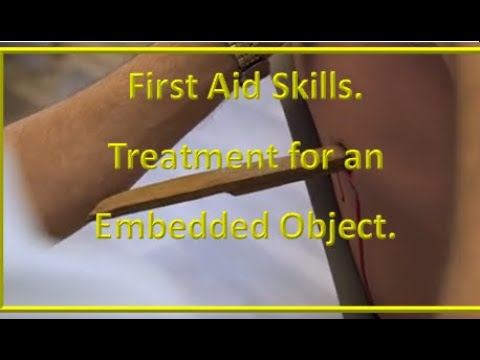 First Aid treatment for chest trauma. Embedded Objects [Video]