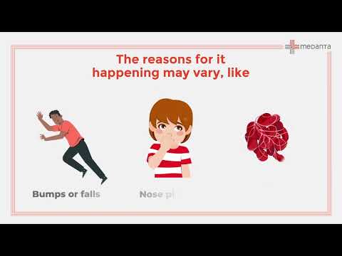 First Aid for tackling Nosebleeds | Medanta [Video]