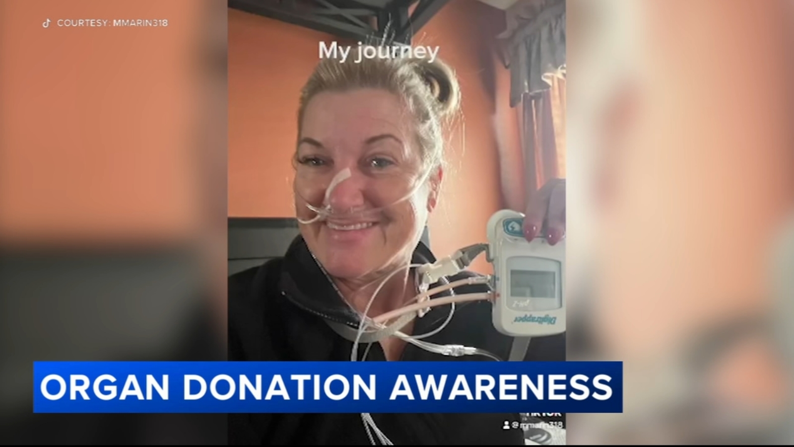 Bucks County woman Marion Marin documents lung transplant, recovery for donor awareness with Temple Lung Center [Video]