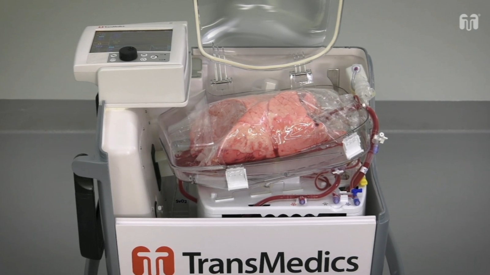 Coordination and new technology help make Temple Health doctors more succesful at dual transplant surgeries [Video]