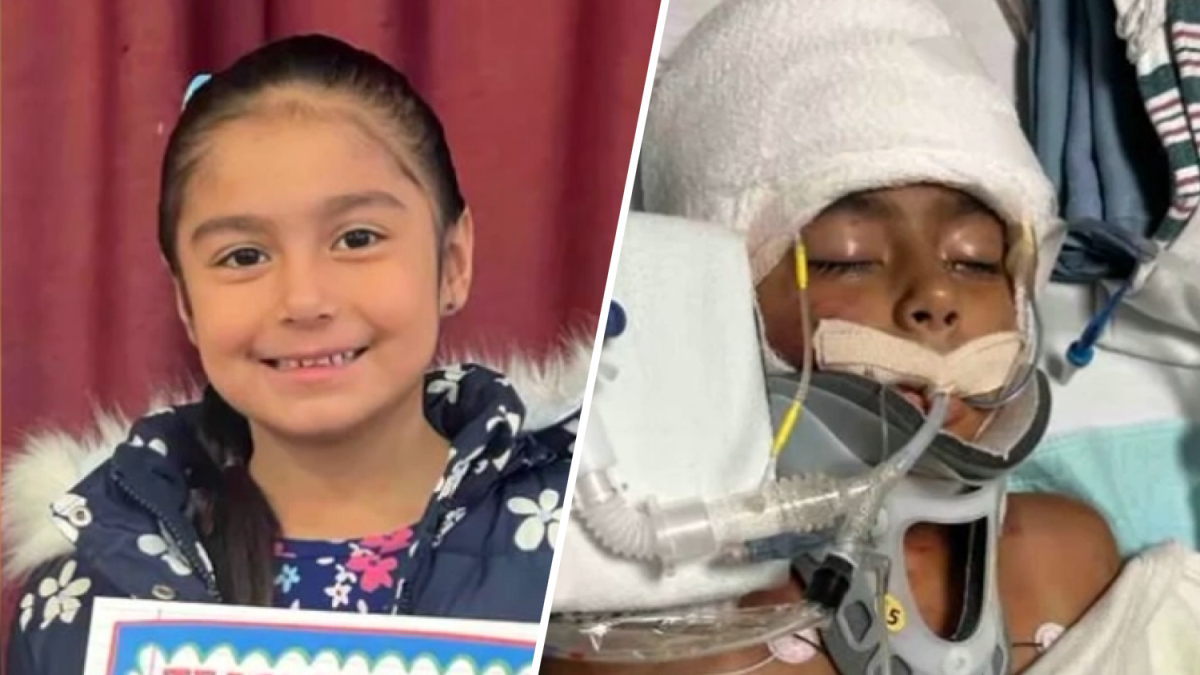 Dog attack leaves 6-year-old in the ICU  NBC Los Angeles [Video]