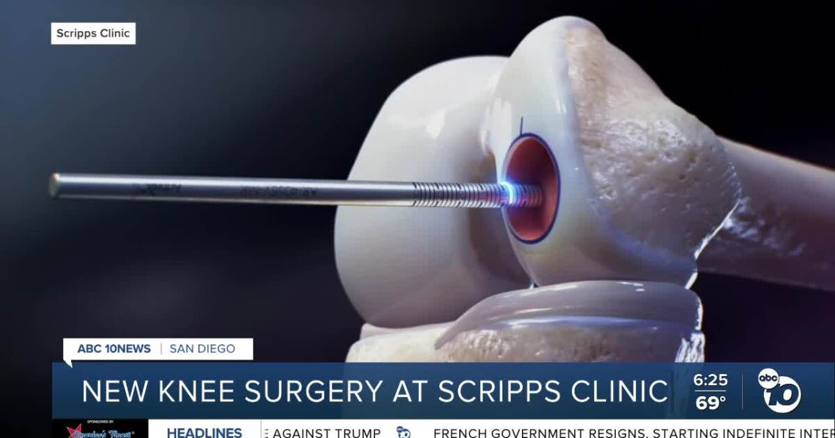 Scripps Healths new surgery gives hope to patients with serious knee injuries [Video]