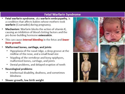 ERMP Case – 16 – Choice of an anticoagulant in pregnancy [Video]