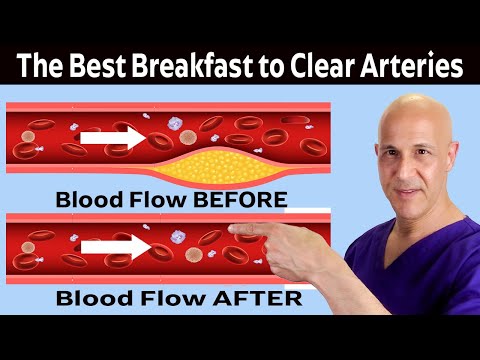 The Healthiest Breakfast to Clean and Open Arteries (Prevent Heart Attack & Stroke)  Dr. Mandell [Video]