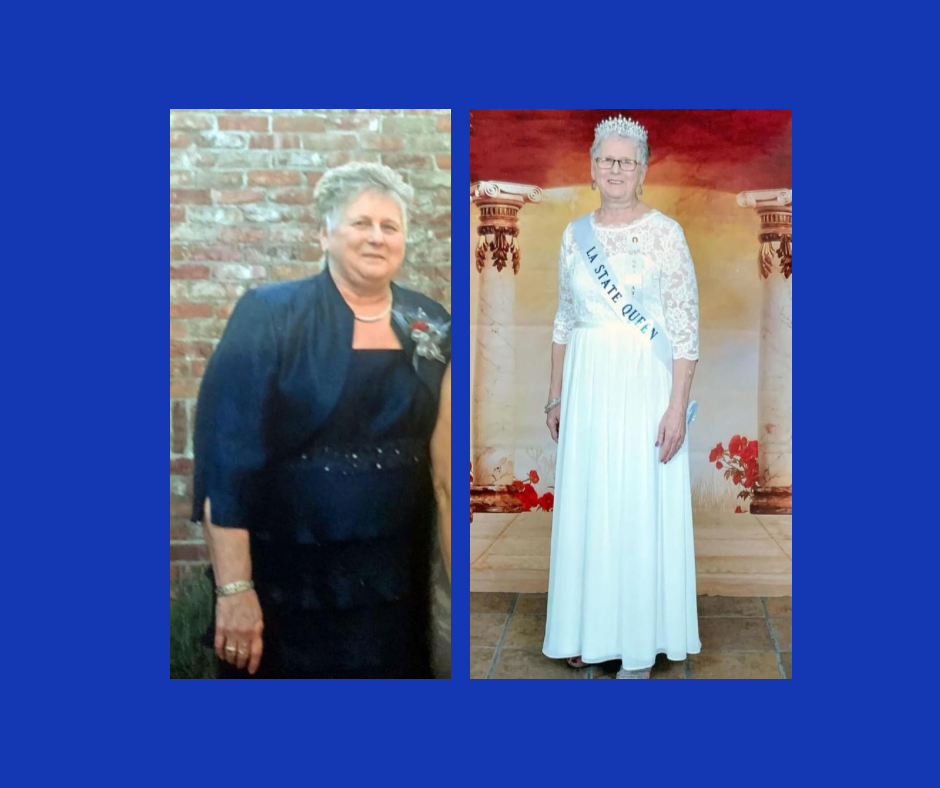 Pierre Part Woman Named 2023 TOPS Louisiana Queen  KQKI News [Video]