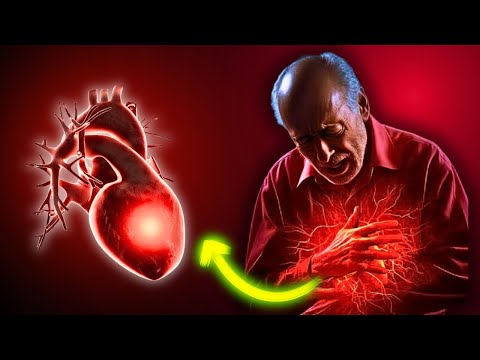 The #1 Natural Cure for Heart Disease That Really Works! ❤️✨ | Proven and Effective Solution! [Video]