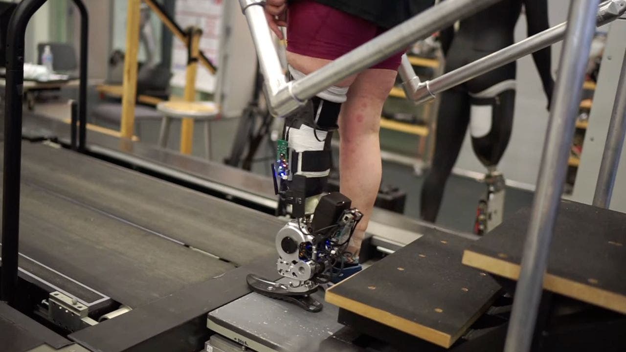New prosthetics restore natural movement via nerve connection [Video]